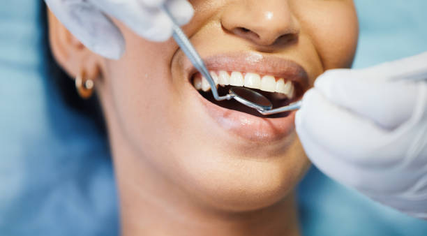 Best Emergency Treatment for Dental Infections or Abscesses in Blackstone, VA